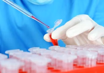 Diagnostyka cukrzycy ciążowej – test glukozy na czczo oraz OGTT